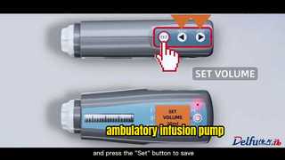 bomba de infusión ambulatoria